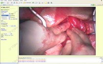 Network Üzerinden Ameliyat İzleme ve Kayıt